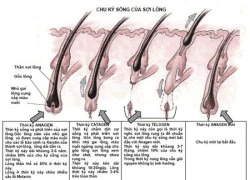 IPL-5G triệt lông như thế nào