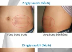 Những sai lầm khi giảm béo cấp tốc