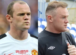 Rooney đi cấy tóc lần hai