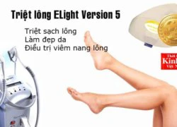 "Mua 5 tặng 5" với dịch vụ triệt lông Version 5