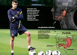 Tito Vilanova và cuộc chiến một năm rưỡi chống lại bệnh ung thư