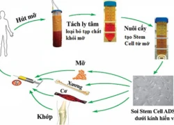 Trắng da toàn thân bằng Stem Cell