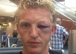 Dirk Kuyt mắt sưng húp sau vụ va chạm với Guzman