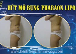 Giảm cân bằng màu sắc