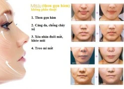 Nâng mũi S-line, căng da 4D bằng chỉ