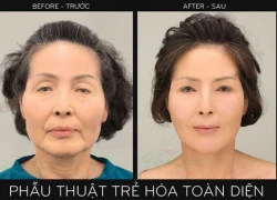 Phẫu thuật thẩm mỹ Hàn Quốc