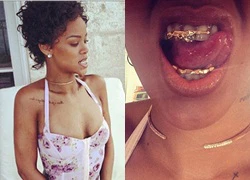 Rihanna gây chú ý với hàm răng đính chiếc súng bằng vàng