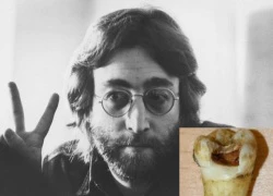 'Tái sinh' John Lennon từ một cái răng sâu