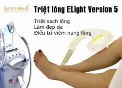 Ưu đãi triệt lông mép mua 5 tặng 5