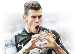 Chuyện chưa kể về Gareth Bale: Đời thay đổi khi... tai thay đổi