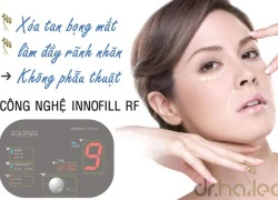 InnoFill RF xóa bọng mắt, đầy rãnh nhăn không phẫu thuật