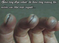 Kim chi và củ cải phần 719: bàn tay đẹp nhất