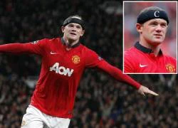 Rooney đeo băng đội trưởng&#8230; trên đầu