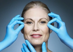 Tiêm Botox khi còn trẻ cho hiệu quả tốt nhất