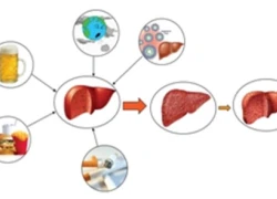 Bí quyết bảo vệ chức năng gan