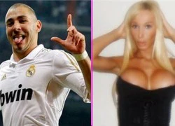 Chuyện tình danh thủ: Benzema vớ phải &#8220;cú có gai&#8221;