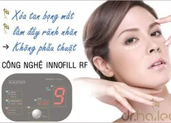 InnoFill RF - xóa bọng mắt không phẫu thuật