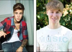 Nhạc sĩ chi hơn 2 tỷ để phẫu thuật giống Justin Bieber