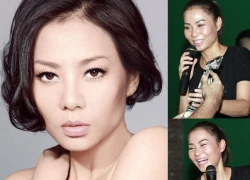 Thu Minh sưng mặt không phải vì tiêm botox