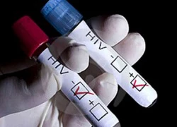 Bắt bác sĩ giúp phạm nhân tại ngoại bằng... "chứng nhận HIV"