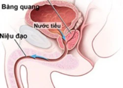 Bệnh của tiền liệt tuyến