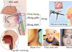 Chiến dịch &#8216;Nói không với bệnh ung thư&#8217;: Phát hiện bệnh trễ, đừng bi quan