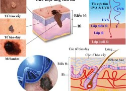 Chiến dịch &#8216;Nói không với bệnh ung thư&#8217;: Tấm che thân thiết