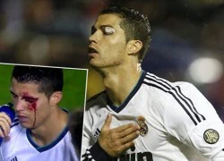 Cú sốc đột quỵ, suýt bỏ mạng trên sân của Ronaldo