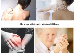 Đau nhức xương khớp: Phương pháp điều trị tiên tiến.