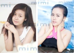 Hé lộ 'đại gia thẩm mỹ Việt ' phẫu thuật cho Bà Tưng