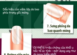 Màu sắc móng tay "mách" bạn tình hình sức khỏe