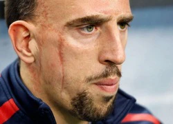 Ribery: Từ đứa bé nghèo mặt sẹo đến siêu sao thế giới