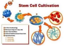 Công nghệ tế bào gốc làm đẹp không phẫu thuật