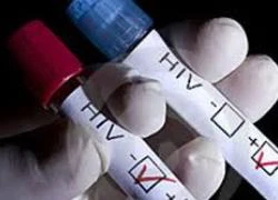 Mỗi năm có thêm 7.000 phụ nữ mang thai nhiễm HIV