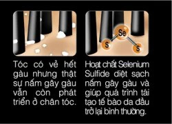 Trắc nghiệm kiến thức về gàu