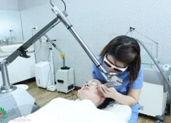 Trị nám da bằng công nghệ Spectra Laser