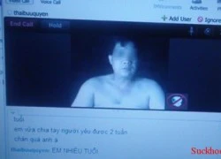 Alo sex tình dục ảo gây bệnh thật