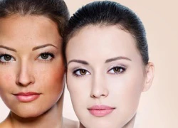 Hồi sinh toàn diện làn da nhờ Glutathione