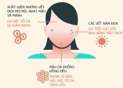 Những dấu hiệu lão hóa da phổ biến