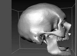 Quét CT sọ người sống phục vụ pháp y