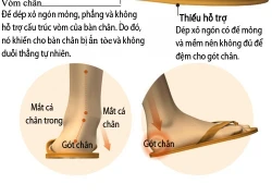 Tác hại của dép xỏ ngón