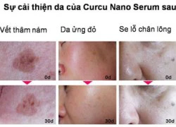 Bí quyết chọn sản phẩm trắng da an toàn