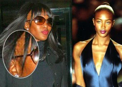 Naomi Campbell lộ đầu hói đáng sợ