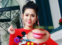 Nghi án Maria Đinh Phương Ánh bơm môi mọng quá đà