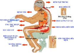 Nhiều nguy cơ khó lường vì ngồi nhiều