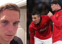 Chuyện Rooney & Van Persie: Thà cứ... đấm nhau như Mignolet