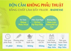 Độn cằm với Filler cho khuôn mặt thanh tú