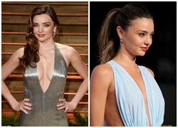 Miranda Kerr "bị tố" bơm ngực