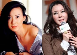 Những "quốc bảo" nhan sắc Cbiz tiêm botox đến... cứng đờ mặt