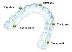 Phương pháp niềng răng nào thẩm mỹ nhất?